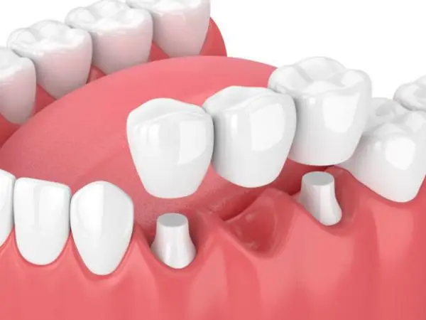 DentLink